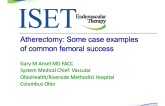 Atherectomy: Some Case Examples of Common Femoral Success