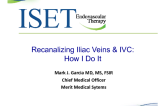 Recanalizing Iliac Veins and IVC: How I Do It