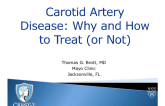 Carotid Artery Disease: Why and How to Treat (or Not)