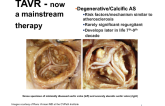 TAVR - now a mainstream therapy