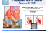 Fundamentals for Safe Vascular Access with TAVR