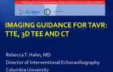 Imaging Guidance For TAVR: TTE, 3D TEE and CT
