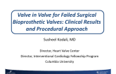 Valve-in-Valve Therapy for Failed Surgical  Bioprosthetic Valves: Clinical Results and  Procedural Approach