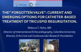 The “Forgotten Valve”: Current and Emerging  Options for Catheter Based Treatment of  Tricuspid Regurgitation