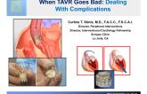 When TAVR Goes Bad: Dealing with  Complications