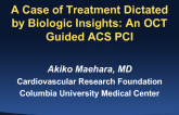 A Case of Treatment Dictated by Biologic Insights: An OCT Guided ACS PCI