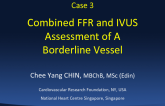 Combined FFR and IVUSAssessment of ABorderline Vessel
