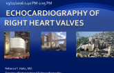 Echocardiolgraphy Of Right Heart Valves
