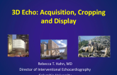 3D Echo: Acquisition, Cropping and Display