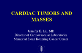 Cardiac Tumors And Masses