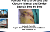 Femoral Vascular Access and Closure (Manual and Device Based): A Step-by-Step Approach