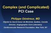 Complex PCI Case 1