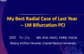My Best Radial Case of Last Year