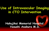 Use of Intravascular Imaging in CTO Intervention