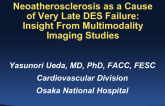 Neoatherosclerosis as A Cause of Very Late DES Failure: Insights From Multimodality Imaging Studies