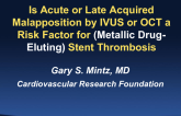 Is Acute or Late Acquired Malapposition By IVUS or OCT A Risk Factor for Stent Thrombosis?