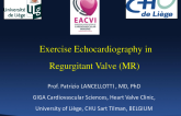 Prognostic and Treatment Decision Implications of Exercise Induced Mitral Regurgitation