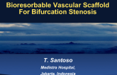 Treatment of Bifurcation Stenosis