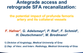 TCT 1423: Antegrade Access and Retrograde SFA Recanalization: the Potential Impact of Profunda Femoris Artery and Its Collateral Vessels