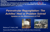 Paravalvular Regurgitation - The Achilles Heel or Problem Solved: Latest Updates on the Assessment of Paravalvular Regurgitation (Aortic and Mitral)