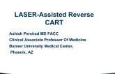 Case #2: Laser-Assisted Reverse CART