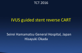 Case #1: IVUS-Guided Stent Reverse CART