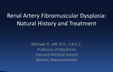 Renal Artery Fibromuscular Dysplasia: Natural History and Treatment