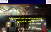 Recannalizing Occluded Systemic Veins Case Presentation (With Discussion)