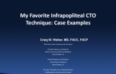 My Favorite Infrapopliteal CTO Techniques: Case Examples