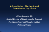 A Case Series of Ischemic and Nonischemic Leg Ulcers