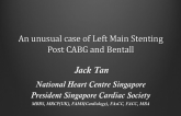 Singapore Presents a Case: Complex PCI