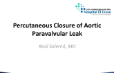 Argentina Presents a Case of a Percutaneous Closure of Paravalvular Aortic Regurgitation