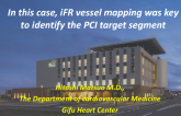 In This Case: iFR Vessel Mapping Was Key to Identify the PCI Target Segment