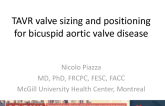 TAVR Valve Sizing and Positioning for Bicuspid Aortic Valve Disease: Is Undersized and Supraannular Best?