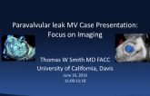 PVL MV Case Presentation: Focus on Imaging