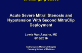 TVT 1022: Acute Severe Mitral Stenosis and Hypotension With Second MitraClip Deployment