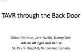 TVT 1103: TAVR Through the Back Door