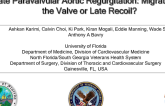 TVT 1075: Late Paravalvular Aortic Regurgitation: Migration of the Valve or Late Recoil?