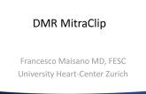 Taped MitraClip Case - Complex MitraClip in DMR