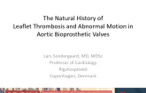 The Natural History of Leaflet Thrombosis and Abnormal Motion in Aortic Bioprosthetic Valves