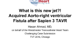 TVT 1079: What Is This New Jet?! Acquired AortoRight Ventricular Fistula After Sapien 3 TAVR