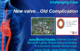 TVT 1098: Stuck Leaflet After Transcatheter Aortic Valve Replacement With a SAPIEN 3 Valve: New Valve... Old Complication