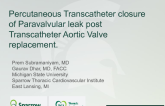 TVT 1105: Percutaneous Transcatheter Closure of Paravalvular Leak After Transcatheter Aortic Valve Replacement