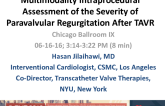 Multimodality Intraprocedural Assessment of the Severity of Paravalvular Regurgitation After TAVR