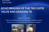 Echo Imaging of the Tricuspid Valve and Grading TR Severity