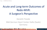Acute and Long-term Outcomes of Redo MVR: A Surgeons Perspective