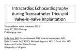 TVT 1182: Intracardiac Echocardiography During Transcatheter Tricuspid Valve-in-Valve Implantation