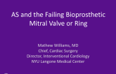 AS and the Failing Bioprosthetic Mitral Valve