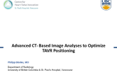 Advanced CT-Based Image Analyses to Optimize TAVR Positioning
