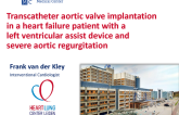 TVT 1130: Transcatheter Aortic Valve Implantation in a Heart-Failure Patient With a Left Ventricular Assist Device and Severe Aortic Regurgitation